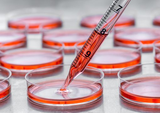 A pipette dispensing liquid into a petri dish filled with red culture medium, with several similar dishes in the background on a laboratory surface—an essential scene in life sciences research.